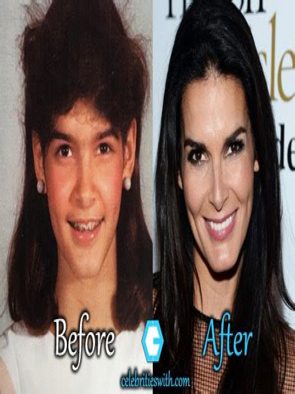 Angie Harmon Plastic Surgery Before and After