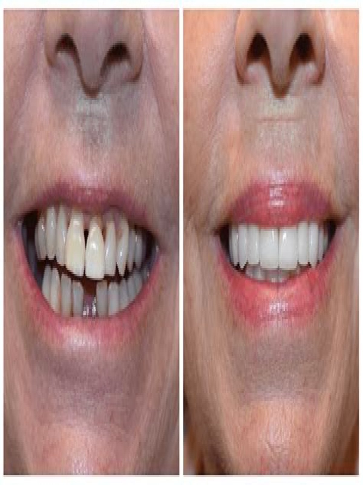 Uncovering The Journey Behind His Radiant Smile